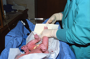 Birth Injury Lawyer in Benton County, WA