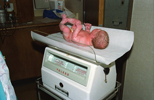 Birth Injury Lawyer in Torrance, CA